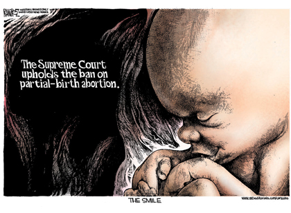 Abortion