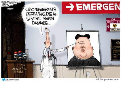 Severe Brain Damage